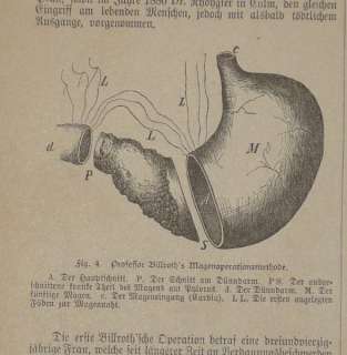 Medizin Verdauungsapparat 2 Blätter 5 Holzstiche 1882  