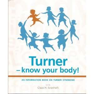  Turner Know Your Body An Information Book on Turner Syndrome 