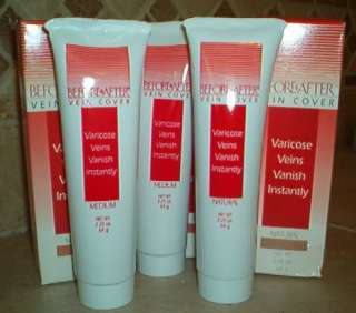 Excellent for covering varicose veins, spider veins, blemishes, scars 